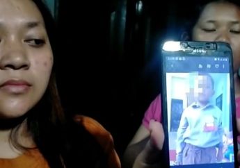 Bocah 6 Tahun di Brebes Mendadak Terkulai Lemas hingga Berat Badannya Turun Drastis Dalam Satu Bulan, Ternyata Ada Benda Mengejutkan Ini Bersarang di Tenggorokan