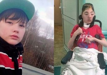 19 Bulan Bertahan Hidup dengan Tengkorak yang Hancur, Anak yang Selamatkan Ibunya dari Pemerkosa Brutal Ini Meninggal Dunia