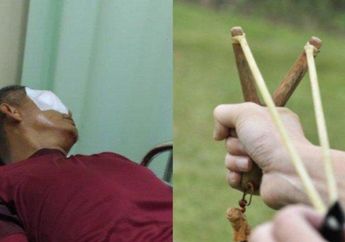 Diketapel Ortu Murid yang Tak Terima Anaknya Ditegur Saat Merokok, Guru di Bengkulu Ini Bola Matanya Hancur dan Terancam Buta