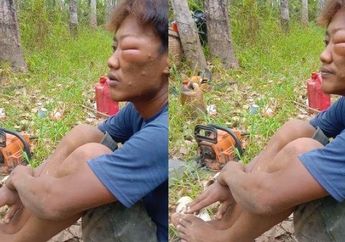 Tebang Pohon di Tengah Hutan pada Hari Jumat, Pria Ini Mendadak Alami Bengkak di Bagian Mata Kiri, Ngaku Lupa Baca Bismillah