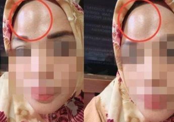 Niat Hati Mau Nagih Duit yang Dihutang Guru Ini, Emak-emak di Sulawesi Selatan Malah Dianiaya Pelaku hingga Dahinya Benjol
