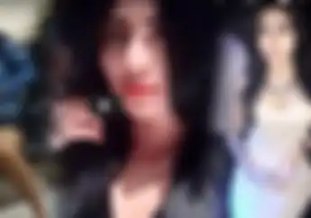 Heboh Wanita Cantik Tabrak Driver Ojol Sampai Putus Kaki, Sudah Salah Malah Marah