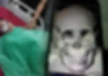 Kronologi Pelemparan Konblok Ke Bocah 9 Tahun Saat Naik Motor Sama Keluarga
