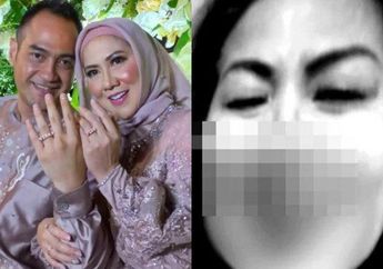 Venna Melinda Nongol Usai Dihajar Ferry Irawan, Ungkap Sempat Ditindih dan Dipiting hingga Darah Ngocor