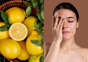 Dipercaya Bisa Atasi Jerawat, 4 Bahan Ini Ternyata Malah Bikin Makin Parah, Acne Fighters Wajib Tahu!