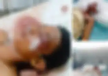 Sedih, Jeritan Pilu Ayah yang Anaknya Jadi Korban Keganasan Geng Motor di Medan