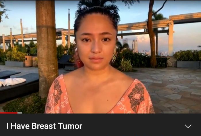 Marshanda saat bercerita mengenai tumor payudara yang dideritanya 