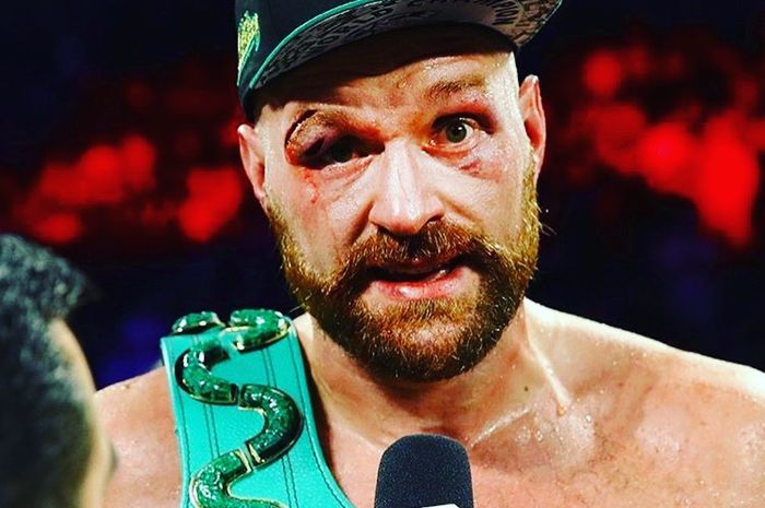 Petinju asal Inggris, Tyson Fury, dianggap cuma buang-buang waktu dengan memilih menggelar duel trilogi dengan Derek Chisora.