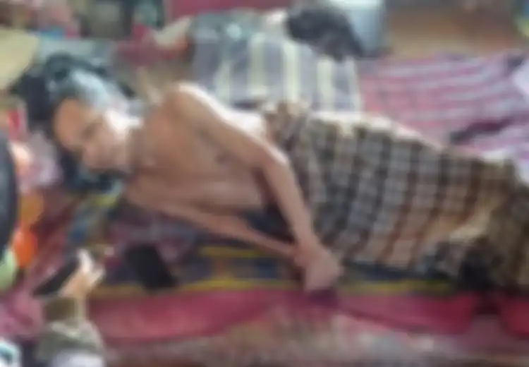 Gara-gara Sembarang Lakukan Ini di Pohon, Tubuh Tepu Tiba-tiba Langsung Kaku Seperti Kayu, Kini Tinggal di Gubuk dan Harus Puasa Kalau Sudah Tak Punya Beras