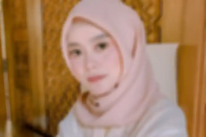 Lesty Kejora tampil manglingi dengan dagu makin lancip