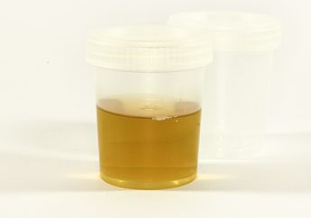 Jangan Dianggap Enteng! Kencing Berbusa Jadi Tanda Bahaya Buat Tubuh, Efeknya Bisa Sampai Cuci Darah Seumur Hidup