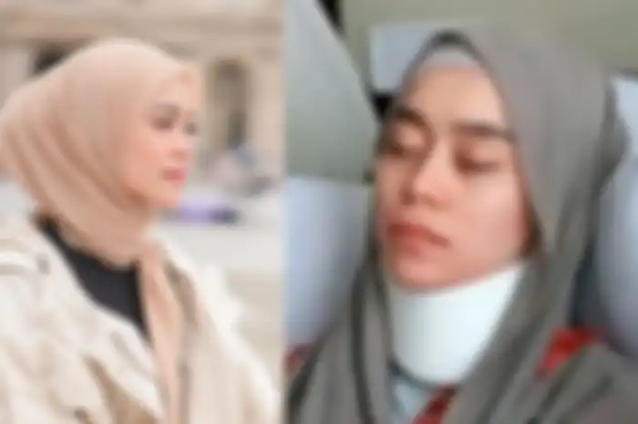 Lesti Kejora alami sejumlah lebam akibat KDRT Rizky Billar
