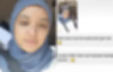 Nabila Ishma Tegur Netizen yang Nyinyir Pada Kondisi Kulit Wajahnya