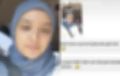 Nabila Ishma Tegur Netizen yang Nyinyir Pada Kondisi Kulit Wajahnya