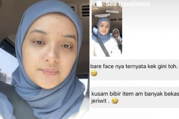 Nabila Ishma dikomentari soal kondisi kulitnya