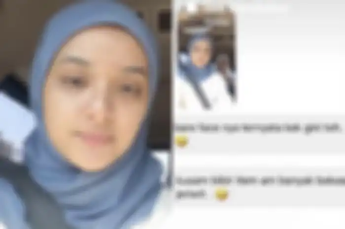 Nabila Ishma dikomentari soal kondisi kulitnya