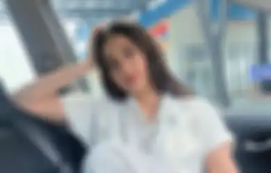 Wajah Dicakar, Selebgram Ini Dianiaya Mantan Pacar Suami, Kisahnya Jadi Trending Topic