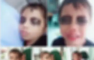 Viral Ibu yang Menghitamkan Mata Anaknya Hingga Si Anak Menangis, Ternyata Ada Alasan Menarik di Baliknya