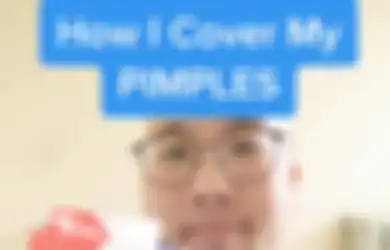 Viral di TikTok Plester Luka Bisa Basmi Jerawat Cuma Semalam! Amankah?