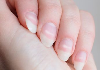 Jangan Sepelekan, Bintik Putih di Kuku Bisa Jadi Pertanda 5 Penyakit Mematikan Ini