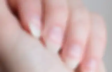 Jangan Anggap Sepele! Bintik Putih di Kuku Bisa Jadi Pertanda Tubuh Alami Hal Ini