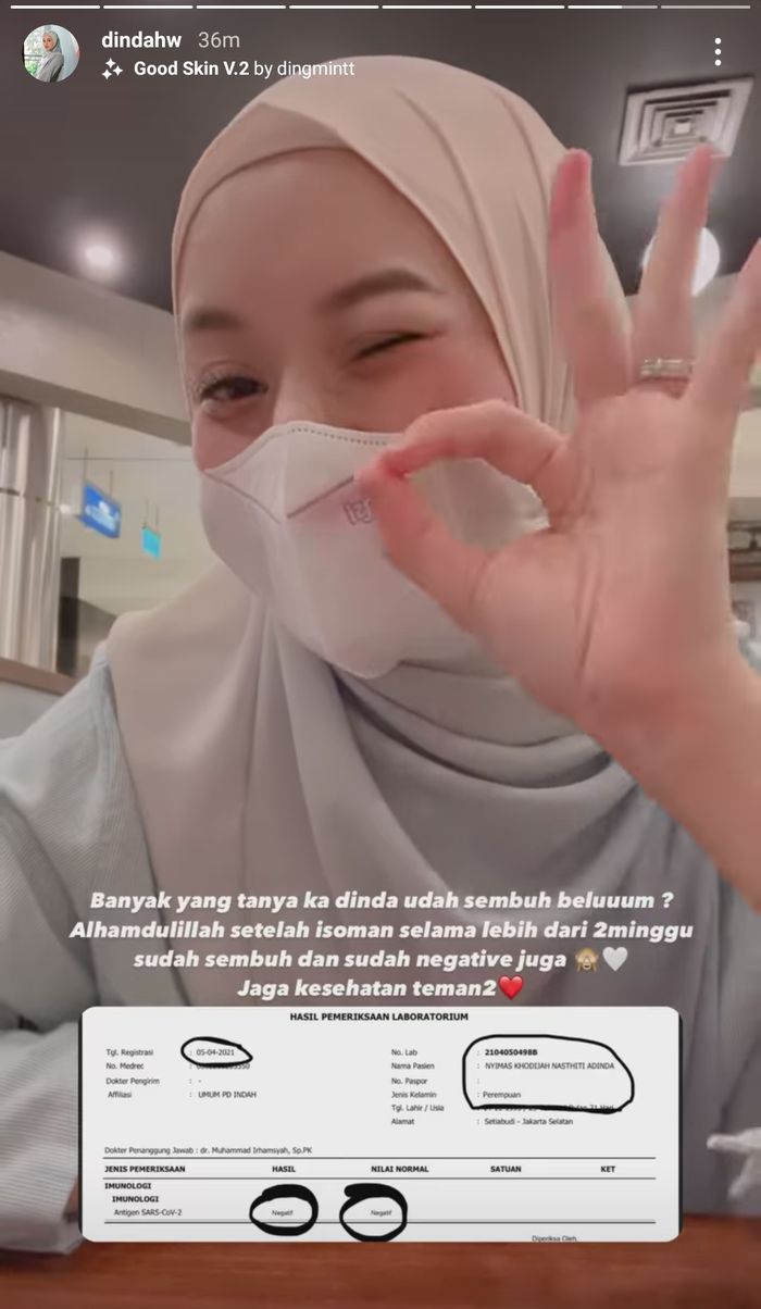Tangkapan layar Instagram Story Dinda Hauw.