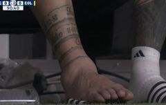 VIDEO - Detik-detik Cedera Horor Bikin Kaki Lionel Messi Bengkak di Final Copa America 2024