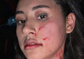 Berawal dari Saling Sindir, Selebgram Afifah Riyad Dianiaya Mantan Pacar Suaminya: Tendangan Berkali-kali di Bagian Caesar