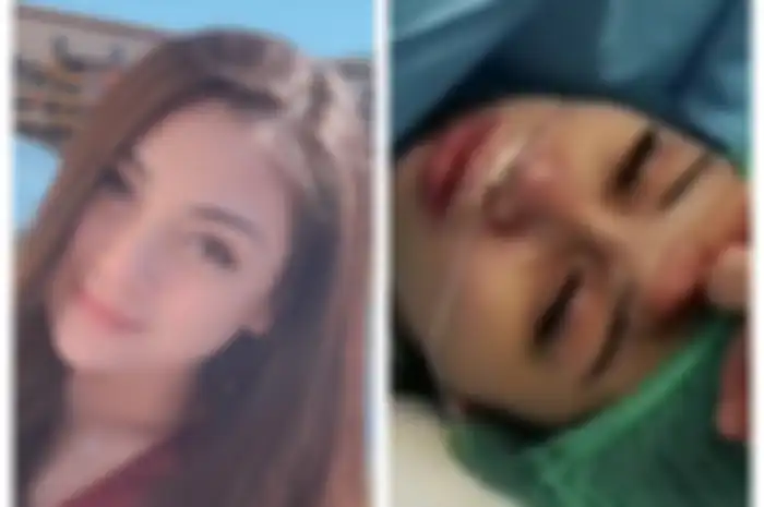 Celine Evangelista bagikan momen operasi caesar, bukti nyata pengorbanan seorang ibu!
