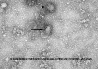RS Hasan Sadikin Sudah Isolasi 2 Pasien Terduga Suspek Corona, Ini Penjelasan Dokternya Mengenai Asal Muasalnya