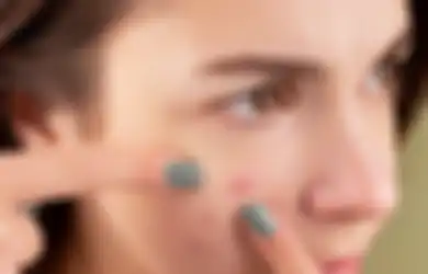 Tips Kecantikan, Daun Sirih Cina Ternyata Ampuh untuk Menghilangkan Jerawat dan Flek Hitam