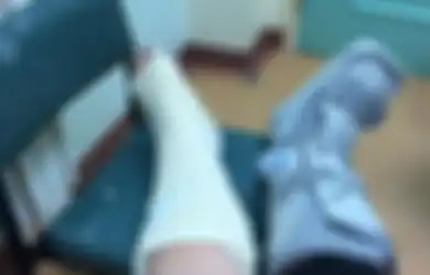 Niat Hati Senang-senang Bikin Video Tik Tok di Tengah Pandemi, Seorang Ibu Justru Harus Mengalami Peristiwa Nahas, Ini yang Terjadi pada Kedua Kakinya