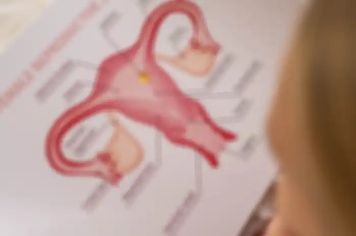 Ilustrasi kista