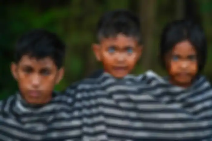 Potret anak bermata biru di Indonesia