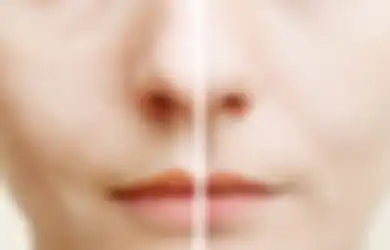 Beauty Date 2020, Skincare Bikin Pori-pori Wajah Remaja Membesar?