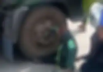 Mengejutkan, Begini Kondisi Emak-emak Ojol yang Kakinya Terlindas Truk di Tanjung Priok