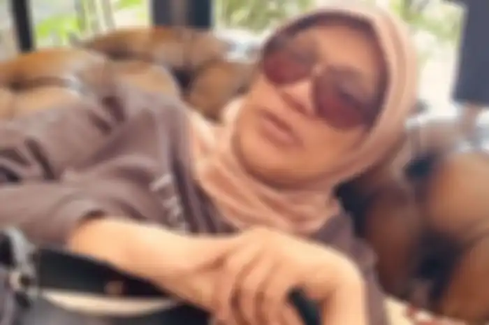 Sahabat Dorce Gamalama sebut biaya pengobatan sang artis telah ditanggung pemerintah