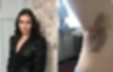 Muncul Banyak Memar Misterius di Tubuhnya, Wanita Ini Meninggal Seminggu Setelah Temui Dokter, Tak Disangka Ada Penyakit Mematikan Ini