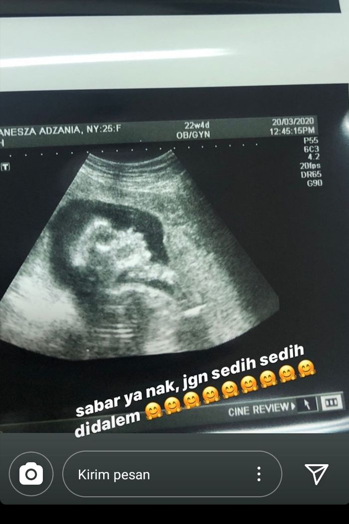 Unggahan USG Vanessa Angel