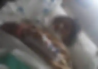 Sempat Kritis dan Masuk ICU Rumah Sakit di Bandung, Begini Kondisi Terbaru Indri Barbie