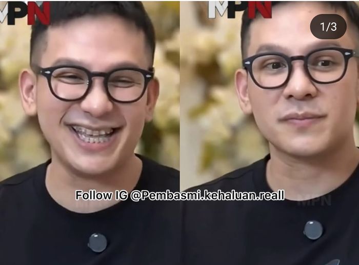 Penampilan baru Jordi Onsu