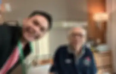 Jadi Penyebab Meninggalnya Ayah Ben Kasyafani, Begini Cara Tekan Risiko Stroke yang Bisa Menyerang Siapa Saja