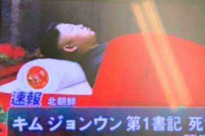 Kim Jong Un dikabarkan alami mati otak