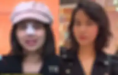 Mayang Oplas Hidung Biar Mancung, Adik Mendiang Vanessa Angel Habiskan Dana Segini, Doddy Sudrajat Puas: Lebih Cantik Ya