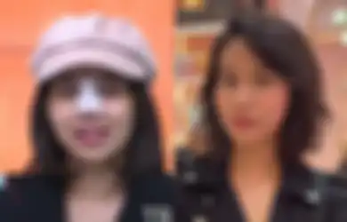 Mayang Gelontorkan Rp50 Juta untuk Opersi Hidung, Adik Vanessa Angel: Kacamatanya Merosot