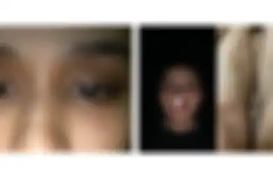 Hidung Bengkok hingga Tubuh Berdarah Disiksa Pacar, Viral Curhatan Mahasiswi UPH Dianiaya Secara Sadis: Paling Parah Cekik Aku
