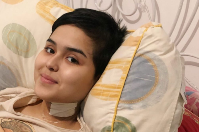 Selebgram Laura Anna meninggal dunia