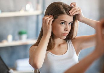 Punya Masalah Rambut Berketombe dan Gatal? Simak 5 Bahan Alami yang Mampu Mengatasinya