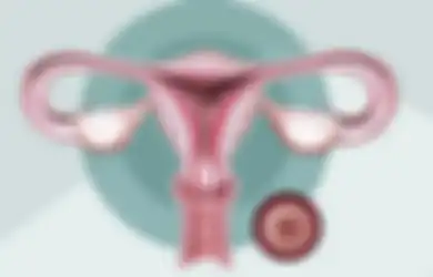 5 Tanda-tanda Kanker Serviks yang Perlu Diwaspadai, Simak Girls