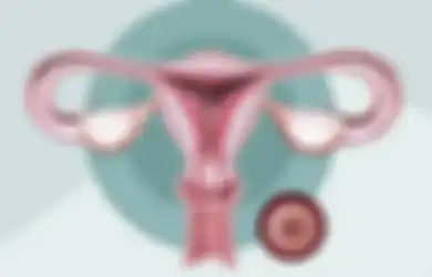 5 Tanda-tanda Kanker Serviks yang Perlu Diwaspadai, Simak Girls